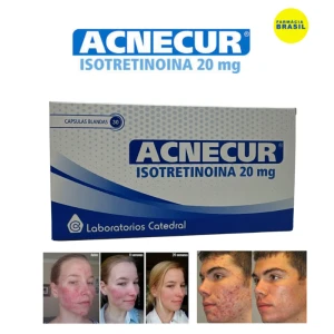 Roacutan isotretinoína 20 mg Acnecur com 30 Cápsulas